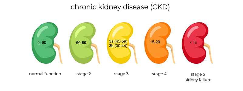 Chronic kidney disease (CKD) - Children's Health