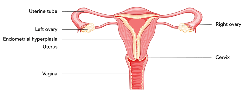 Adolescent gynecology exam anatomy - Chidlren's Health