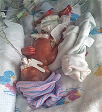 Pharaoh in NICU