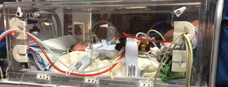 Pharaoh in Neonatal Intensive Care Unit